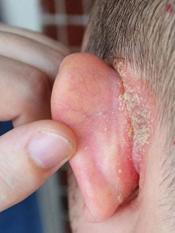 My Child Woke Up with a Spot on Their Ear: What Could It Be and How to Care for It Until the Appointment?