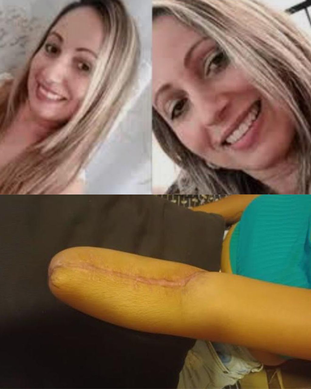 Teacher Injured During School Attack in Suzano