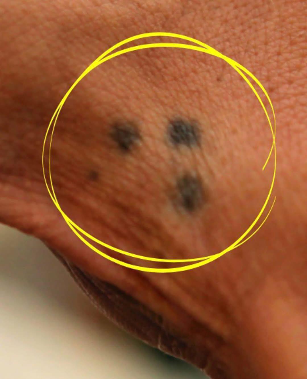 The Three-Dot Tattoo: A Simple Mark with Profound Meanings You Should Know