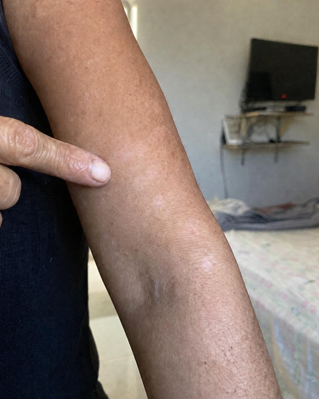 What Causes White Spots on Your Skin? Exploring the Possible Reasons